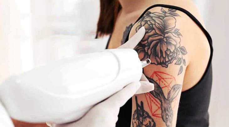 Can You Get Laser Hair Removal Over A Tattoo Frequently Answered