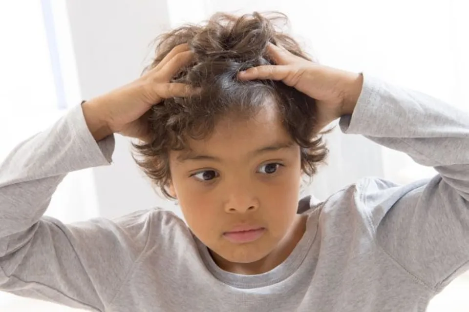 Do Lice Like Clean Or Dirty Hair? Let's See